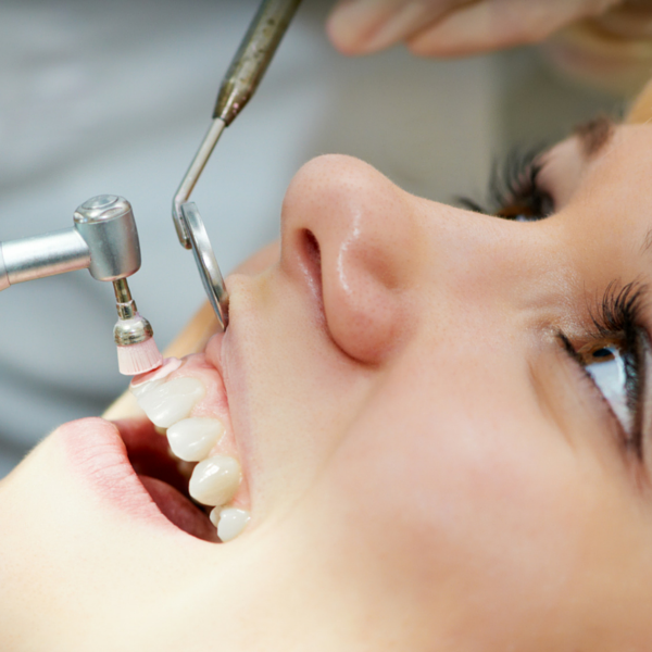 limpieza bucal practicada por dentista