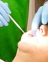 pulpectomia dentista en guadix